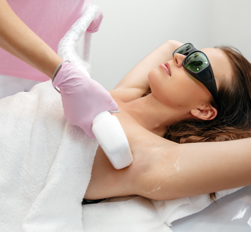 Laser Treatments