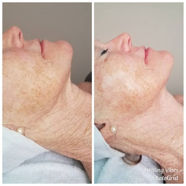 Slide image 3 of 4 for healing-vibes-esthetics