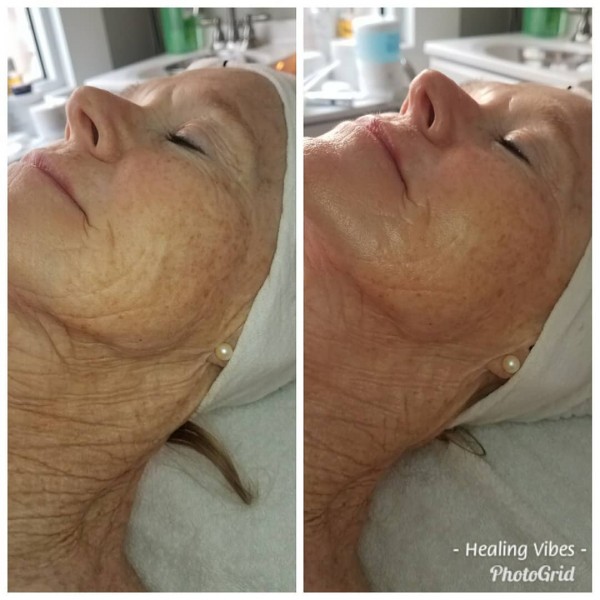 Slide image 4 of 4 for healing-vibes-esthetics