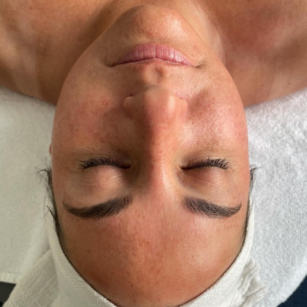 Slide image 2 of 4 for healing-vibes-esthetics